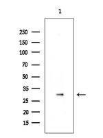 Phospho-CDK6 (Tyr24) Antibody in Western Blot (WB)