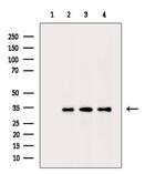Phospho-CDK6 (Tyr292) Antibody in Western Blot (WB)
