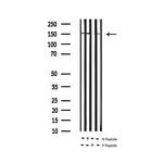 Phospho-EGFR (Tyr1197) Antibody in Western Blot (WB)