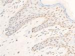 Phospho-TK1 (Ser13) Antibody in Immunohistochemistry (Paraffin) (IHC (P))