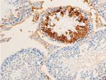 Phospho-TK1 (Ser13) Antibody in Immunohistochemistry (Paraffin) (IHC (P))