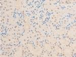 Phospho-TK1 (Ser13) Antibody in Immunohistochemistry (Paraffin) (IHC (P))