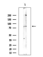 Phospho-PKC beta (Ser661) Antibody in Western Blot (WB)