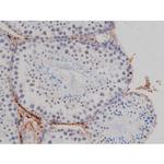 Phospho-NPM1 (Thr199) Antibody in Immunohistochemistry (Paraffin) (IHC (P))