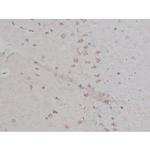 Phospho-NPM1 (Thr199) Antibody in Immunohistochemistry (Paraffin) (IHC (P))