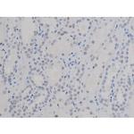 Phospho-NPM1 (Thr199) Antibody in Immunohistochemistry (Paraffin) (IHC (P))