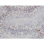 Phospho-NPM1 (Thr199) Antibody in Immunohistochemistry (Paraffin) (IHC (P))