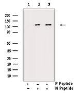 Phospho-CSF1R (Tyr809) Antibody in Western Blot (WB)