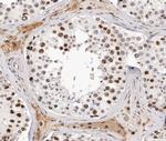 Phospho-Androgen Receptor (Ser651) Antibody in Immunohistochemistry (Paraffin) (IHC (P))