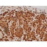 Phospho-Ezrin (Tyr354) Antibody in Immunohistochemistry (Paraffin) (IHC (P))