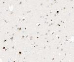 Phospho-C/EBP beta (Thr235, Thr188) Antibody in Immunohistochemistry (Paraffin) (IHC (P))