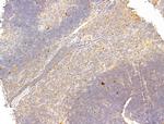 Phospho-p70 S6 Kinase (Thr389, Thr412) Antibody in Immunohistochemistry (Paraffin) (IHC (P))