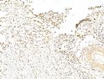 Phospho-p70 S6 Kinase (Thr389, Thr412) Antibody in Immunohistochemistry (Paraffin) (IHC (P))