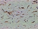 Phospho-PI3K p85 alpha (Tyr607) Antibody in Immunohistochemistry (Paraffin) (IHC (P))