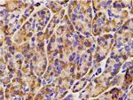 Phospho-PI3K p85 alpha (Tyr607) Antibody in Immunohistochemistry (Paraffin) (IHC (P))