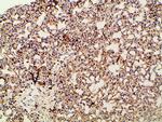 Phospho-PI3K p85 alpha (Tyr607) Antibody in Immunohistochemistry (Paraffin) (IHC (P))