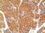 Phospho-PI3K p85 alpha (Tyr607) Antibody in Immunohistochemistry (Paraffin) (IHC (P))