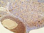 Phospho-PI3K p85 alpha (Tyr607) Antibody in Immunohistochemistry (Paraffin) (IHC (P))