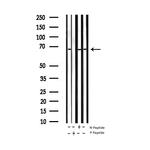 Phospho-ZAP-70 (Tyr319) Antibody in Western Blot (WB)