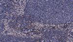 Phospho-MEK3 (Ser189) Antibody in Immunohistochemistry (Paraffin) (IHC (P))