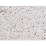 Phospho-NFkB p65 (Ser281) Antibody in Immunohistochemistry (Paraffin) (IHC (P))