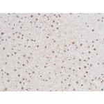 Phospho-NFkB p65 (Ser281) Antibody in Immunohistochemistry (Paraffin) (IHC (P))