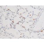 Phospho-NFkB p65 (Ser281) Antibody in Immunohistochemistry (Paraffin) (IHC (P))