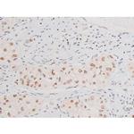 Phospho-NFkB p65 (Ser281) Antibody in Immunohistochemistry (Paraffin) (IHC (P))