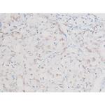 Phospho-NFkB p65 (Ser281) Antibody in Immunohistochemistry (Paraffin) (IHC (P))