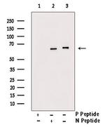 Phospho-NFkB p65 (Ser281) Antibody in Western Blot (WB)