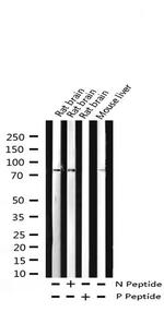 Phospho-PKC delta (Tyr313) Antibody in Western Blot (WB)