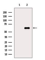 Phospho-CAMKIV (Thr200) Antibody in Western Blot (WB)