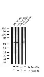 Phospho-RPS6KB2 (Ser423) Antibody in Western Blot (WB)