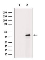 Phospho-GRAP2 (Thr262) Antibody in Western Blot (WB)