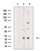 Phospho-SAR1A (Thr139) Antibody in Western Blot (WB)