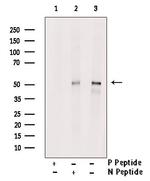 Phospho-Naked2 (Tyr247) Antibody in Western Blot (WB)