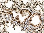 Acetyl-p53 (Lys373) Antibody in Immunohistochemistry (Paraffin) (IHC (P))