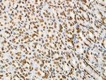 Acetyl-p53 (Lys373) Antibody in Immunohistochemistry (Paraffin) (IHC (P))