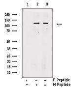 Phospho-ULK1 (Ser638) Antibody in Western Blot (WB)