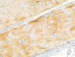 Phospho-HCLS1 (Tyr397) Antibody in Immunohistochemistry (Paraffin) (IHC (P))