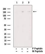 Phospho-RASGRF1 (Ser927) Antibody in Western Blot (WB)