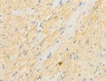 Phospho-RASGRF1 (Ser927) Antibody in Immunohistochemistry (Paraffin) (IHC (P))