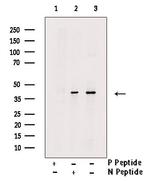 Phospho-TOB1 (Ser164) Antibody in Western Blot (WB)