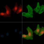 Phospho-ErbB4 (Tyr984) Antibody in Immunocytochemistry (ICC/IF)