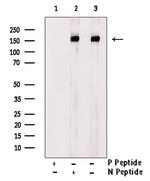 Phospho-ErbB4 (Tyr984) Antibody in Western Blot (WB)