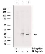 Phospho-MOB4A (Thr12) Antibody in Western Blot (WB)