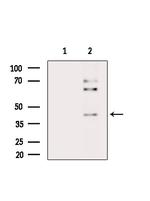 Phospho-PAR4 (Thr163) Antibody in Western Blot (WB)