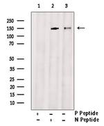 Phospho-BRIP1 (Thr1133) Antibody in Western Blot (WB)