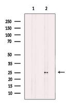 MOB4A Antibody in Western Blot (WB)