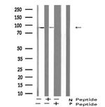 Phospho-ATRIP (Ser224) Antibody in Western Blot (WB)